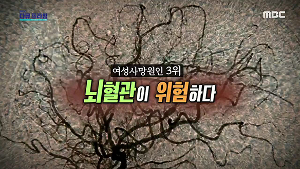 여성사망원인 3위, 중년의 혈관이 위험하다