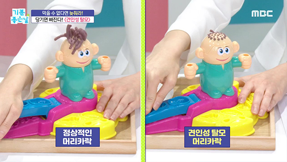 레전드 매치 극과 극! 10년 회춘의 비밀