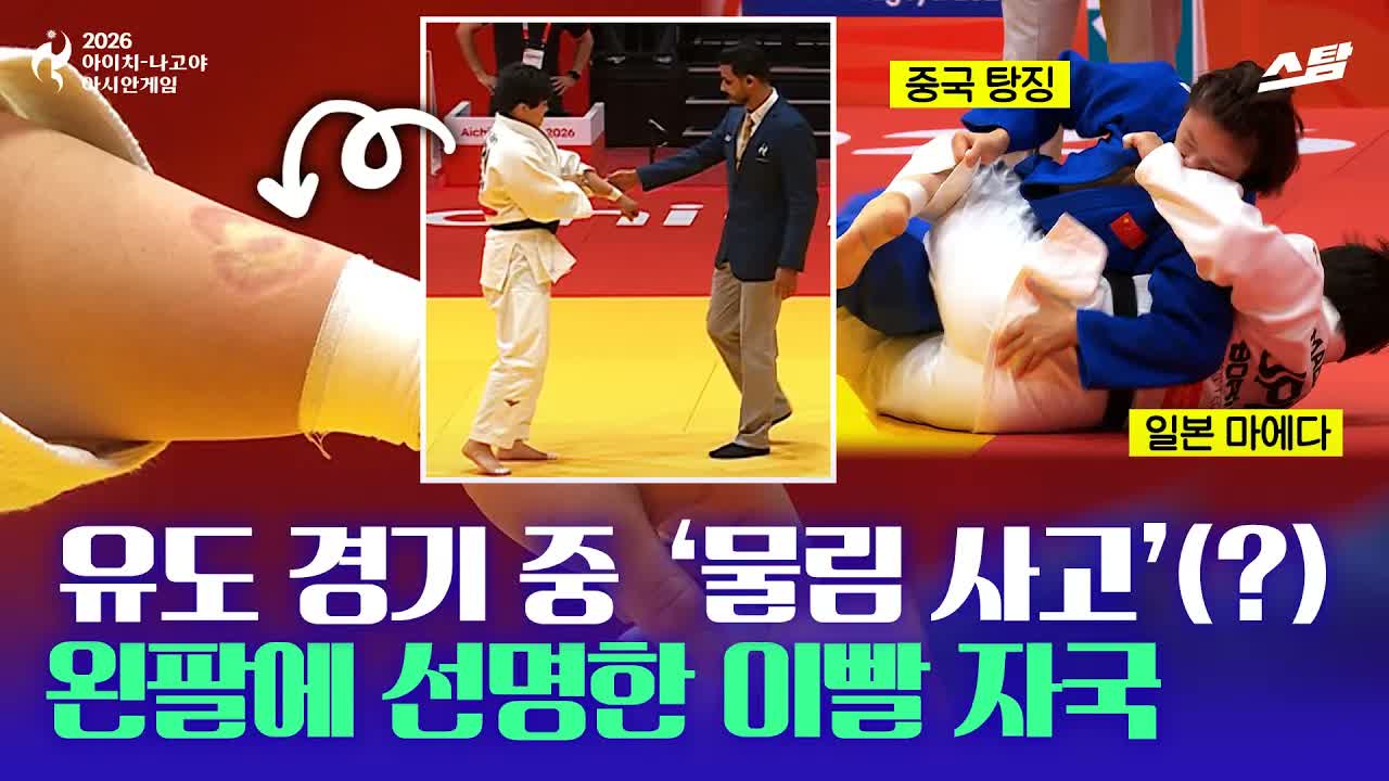 상대 물어뜯은 중국 선수.. 팔에 선명한 이빨 자국!!  클립