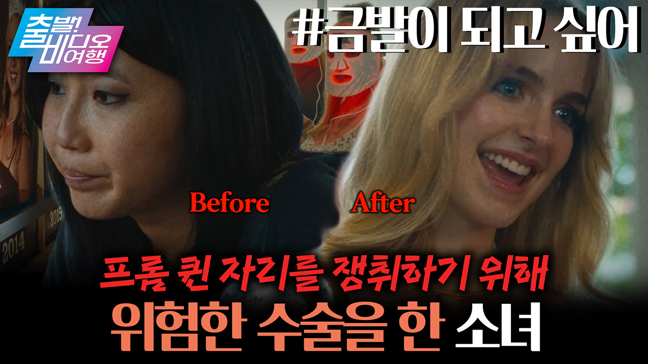 지독한 차별에 시달리다 백인이 되기 위에 수술대에 오른 소녀 클립