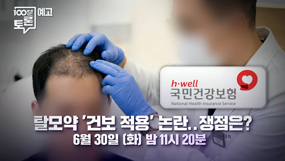 탈모약 '건보 적용' 논란..쟁점은?