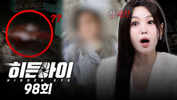 수술 중에 퇴근한 의사 /  살인 비디오 속 범인의 정체
