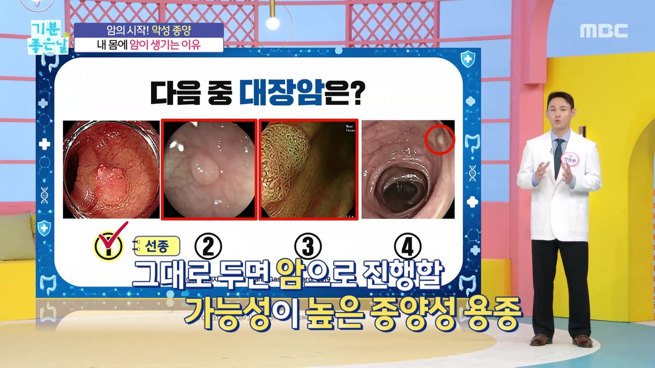 내 인생의 암(2)