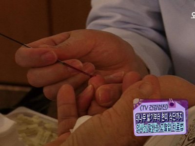 [TV건강검진] 명의가 말하는 고혈압 고치는 식단! 클립 이미지