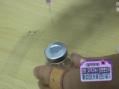 [현장취재] 무허가, 밀수입 성형 보형물로 시술한 의사들 클립 이미지