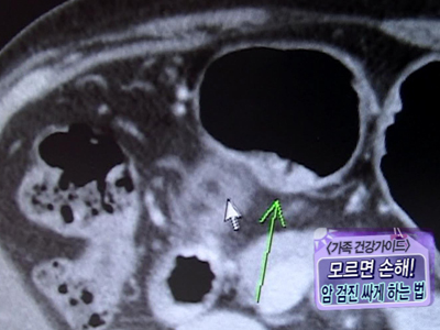 [가족 건강가이드] 모르면 손해! 무료 건강검진! 클립 이미지