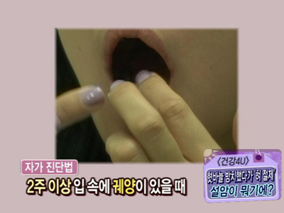 설암 자가 진단법 클립 이미지