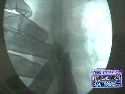 [힐링!건강주치의] "바람만 스쳐도 아야야!" 악마의 병 ‘만성통증증후군’ 클립 이미지