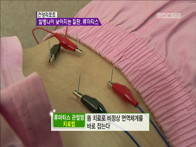 건강 리포트! 젊음을 위협하는 노인 질환 클립 이미지