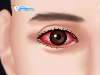 만병상담소 - 바캉스 후유증