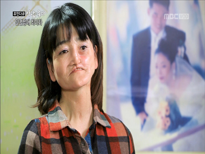 안면장애 최미화 씨의 캠퍼스 스토리 클립 이미지