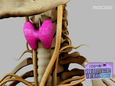 [건강기획] ‘줄줄줄’ 흐르는 땀 알고 보면 내 몸이 보내는 000 경보! 클립 이미지