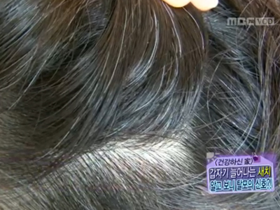 [건강하신家] 갑자기 늘어나는 새치! 알고 보니 탈모의 신호?! 클립 이미지