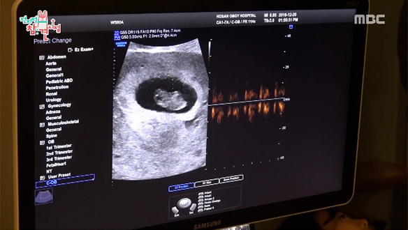 반가워 쏭이야♡ 콩닥콩닥 숨 쉬는 아기 천사♡ 클립 이미지