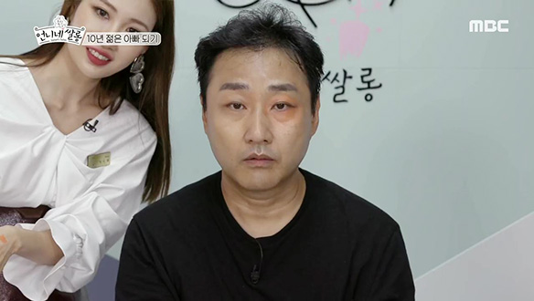 수용의 얼굴에 생기를 불어넣는 사배, 다크서클 완벽 커버! 클립 이미지