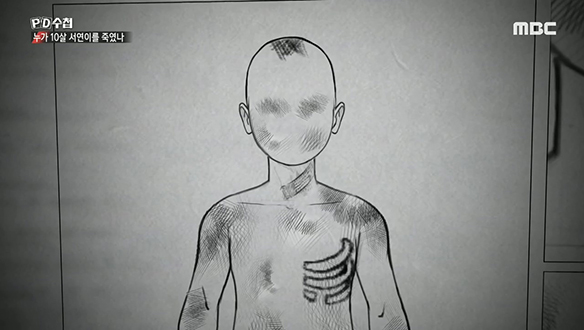 이모에게 살해당한 10살 소녀 클립 이미지