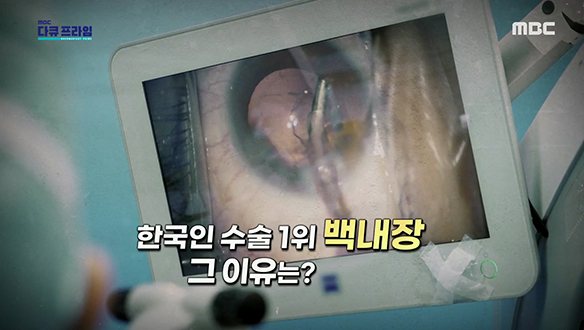 한국인 수술 1위 백내장
