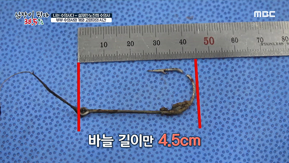 작고 연약한 '설하'를 괴롭힌 낚싯바늘 제거 수술! 클립 이미지